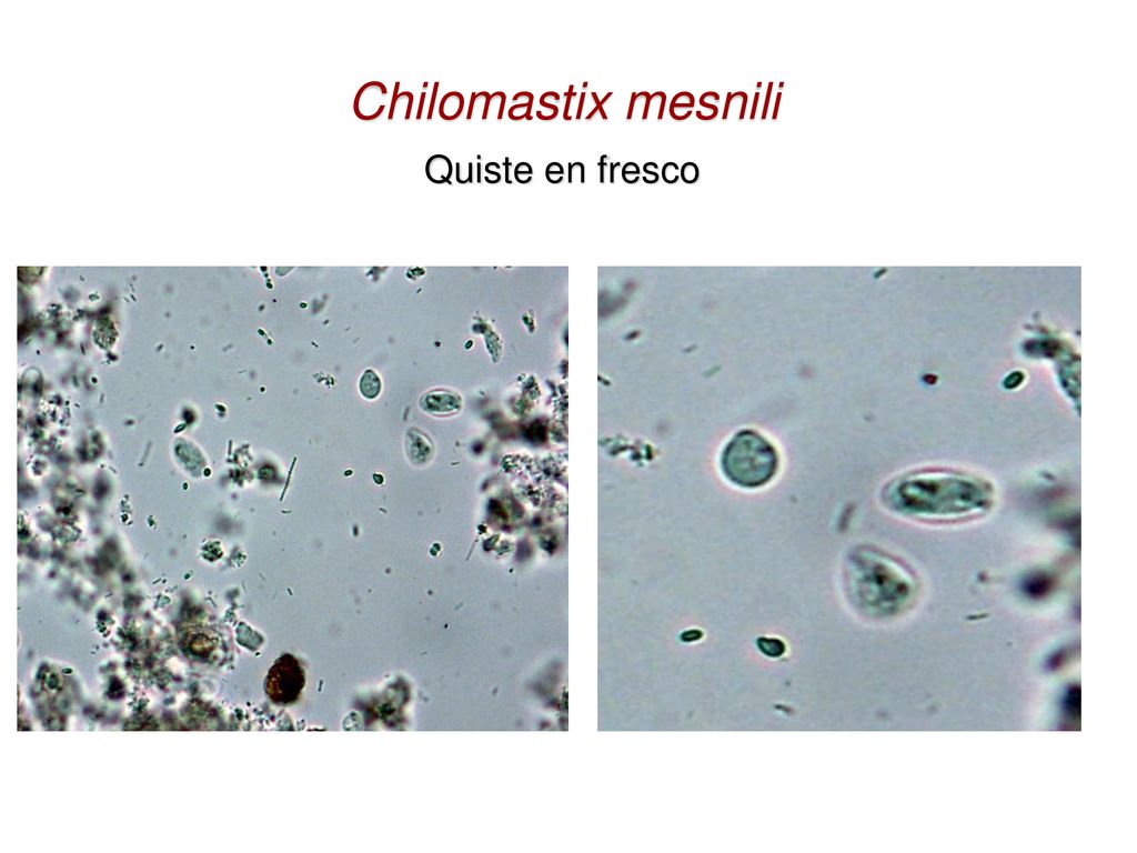 trofozoitos y quistes de chilomastix mesnili